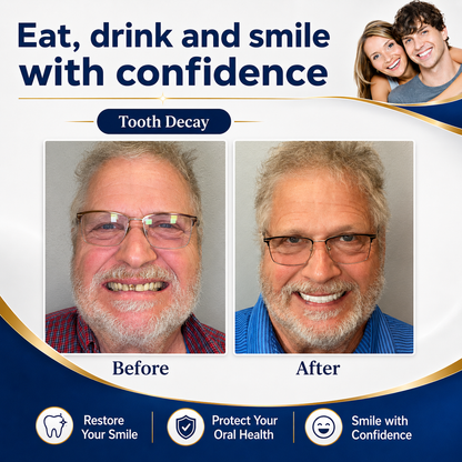 Custom-Fit Instant Smile Dentures – Natural Looking Comfort Fit