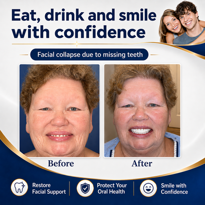 Custom-Fit Instant Smile Dentures – Natural Looking Comfort Fit