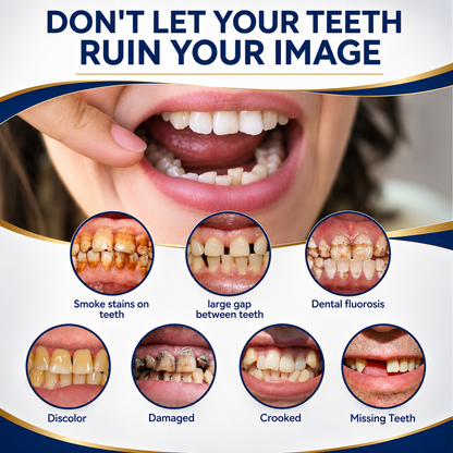 Custom-Fit Instant Smile Dentures – Natural Looking Comfort Fit