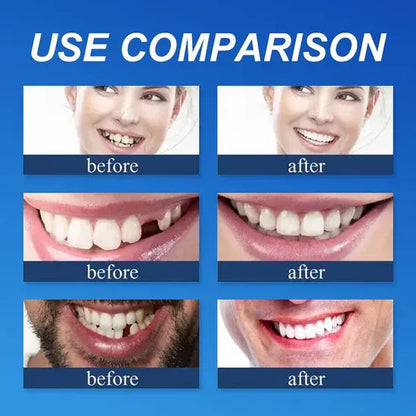 ⏰Ends Today: 50% OFF!  Custom-Fit — Designed for Comfort and a Natural-Looking Smile